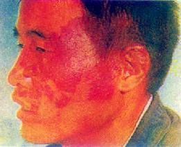 ëϸѪ��<a href=