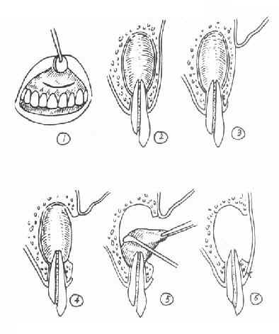 ��������ժ����