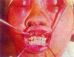 ���ǹ���