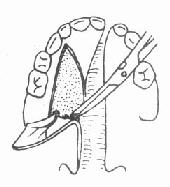 ��������Ĥ