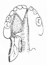 ��ճ��Ĥ���������λ