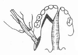 ����õ����