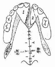 ���ǰ����϶�п�