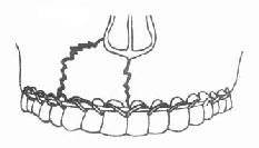 ��������а�̶�