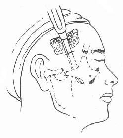 򨲿�п���λ��