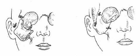 �п���λ�����̶���