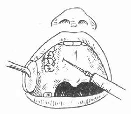 ����ע��