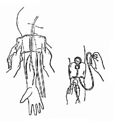 ��֫�Ŷ���������