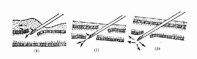 ����ע�����Ѫ