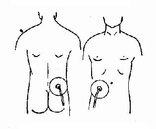 ��β�׵����Ʒ���