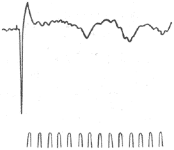 ���ô���Ƥ��о��˶����շ���λ