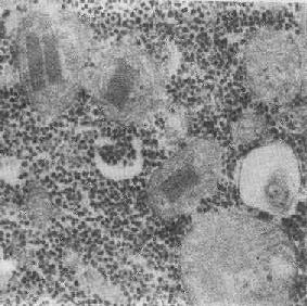 �������ھ��ΰ����壨�����Լ�Ӫ������֢��