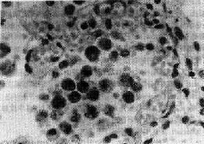 ���Է���Ѫ