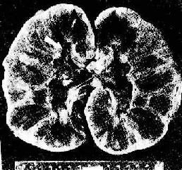 ����ֲ�����ųⷴӦ