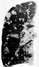 ���ڵ�Ѫ��ת����<a href=