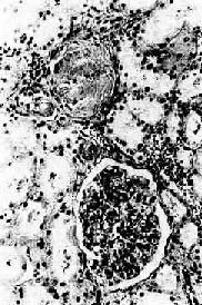 ��Ѫѹ��֮��