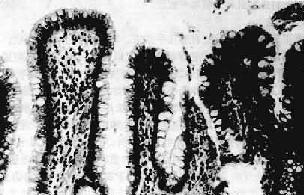 θճĤ����Ƥ����