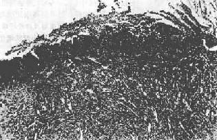 ����θ����ײ�