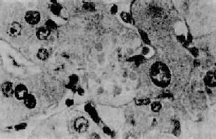 �ƾ��Ը���