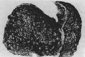 �������Ը�Ӳ��