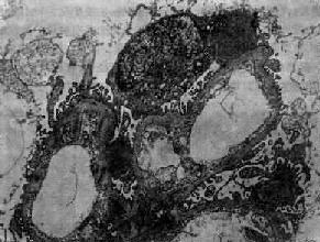 ëϸѪ������������С������