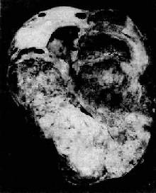 ��ĸϸ��<a href=