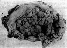 �ӹ�����<a href=