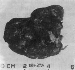 ���ѹ�����