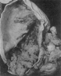 �ѳ���ͷ״��Һ������<a href=