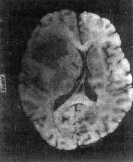 ���ν���ϸ��<a href=