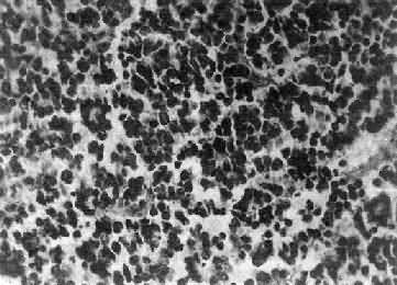 ��ĸϸ��<a href=