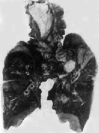 �ν�˲�ԭ���ۺ���