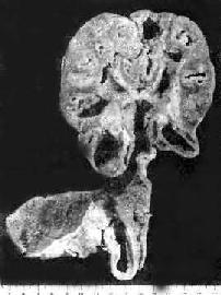 ����˼�����ܽ��