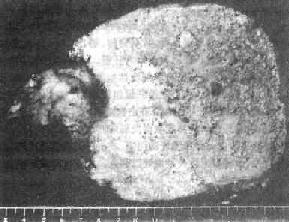 ����״�����ʲ����޿��ͣ�