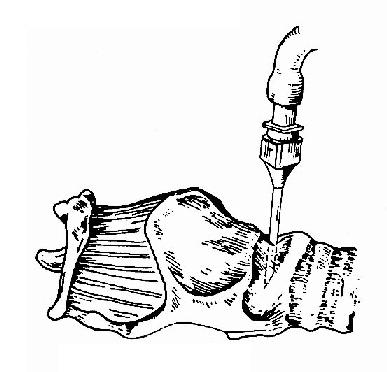 ����Ĥ����