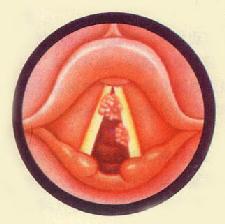 ������ͷ״<a href=