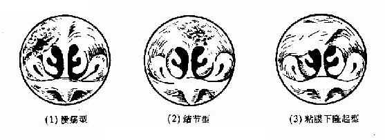 ����<a href=