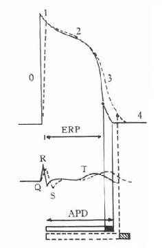 ���ᶡ�����Ҽ�������λ��������ͼ���У���ERP��APDӰ���ģʽͼ